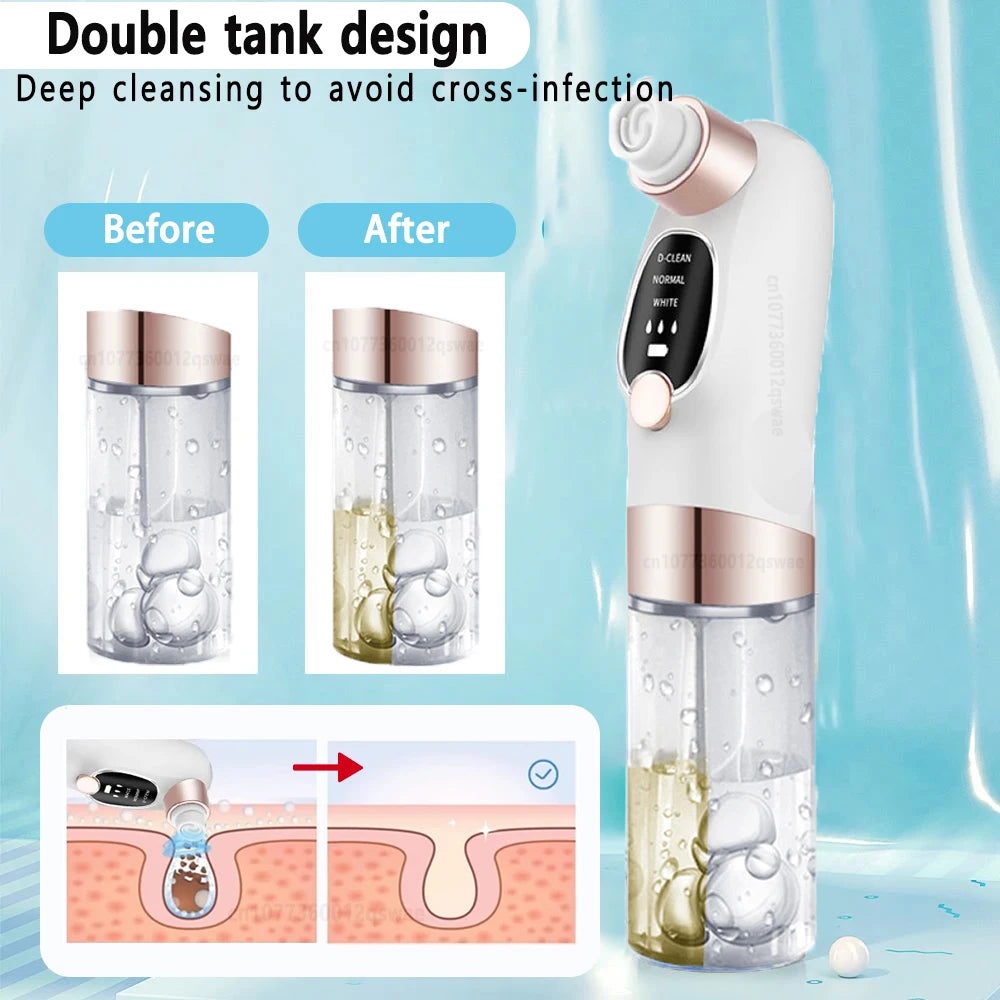 Blackhead Vacuum Deep Pore & Acne Cleaner