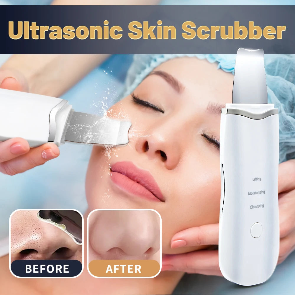 Blackhead Remover & Pore Cleaner Tool