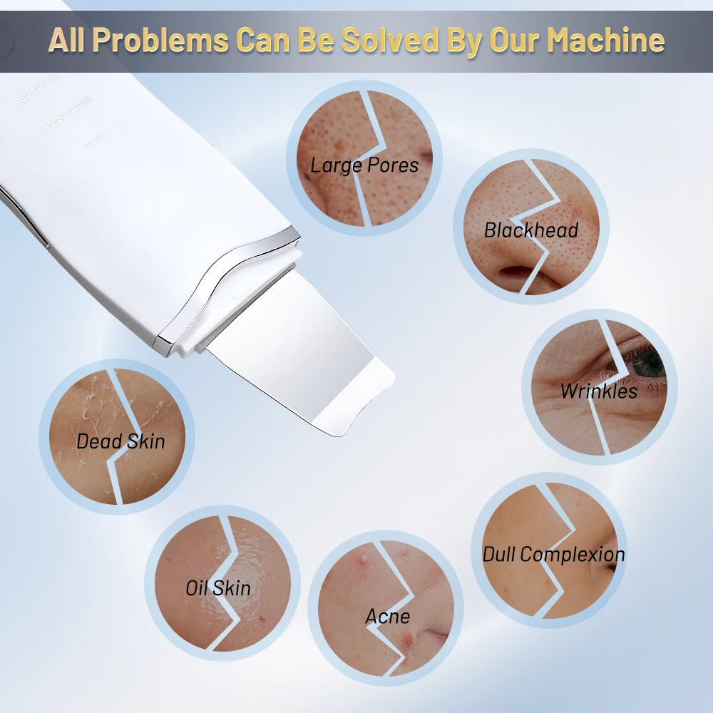 Blackhead Remover & Pore Cleaner Tool