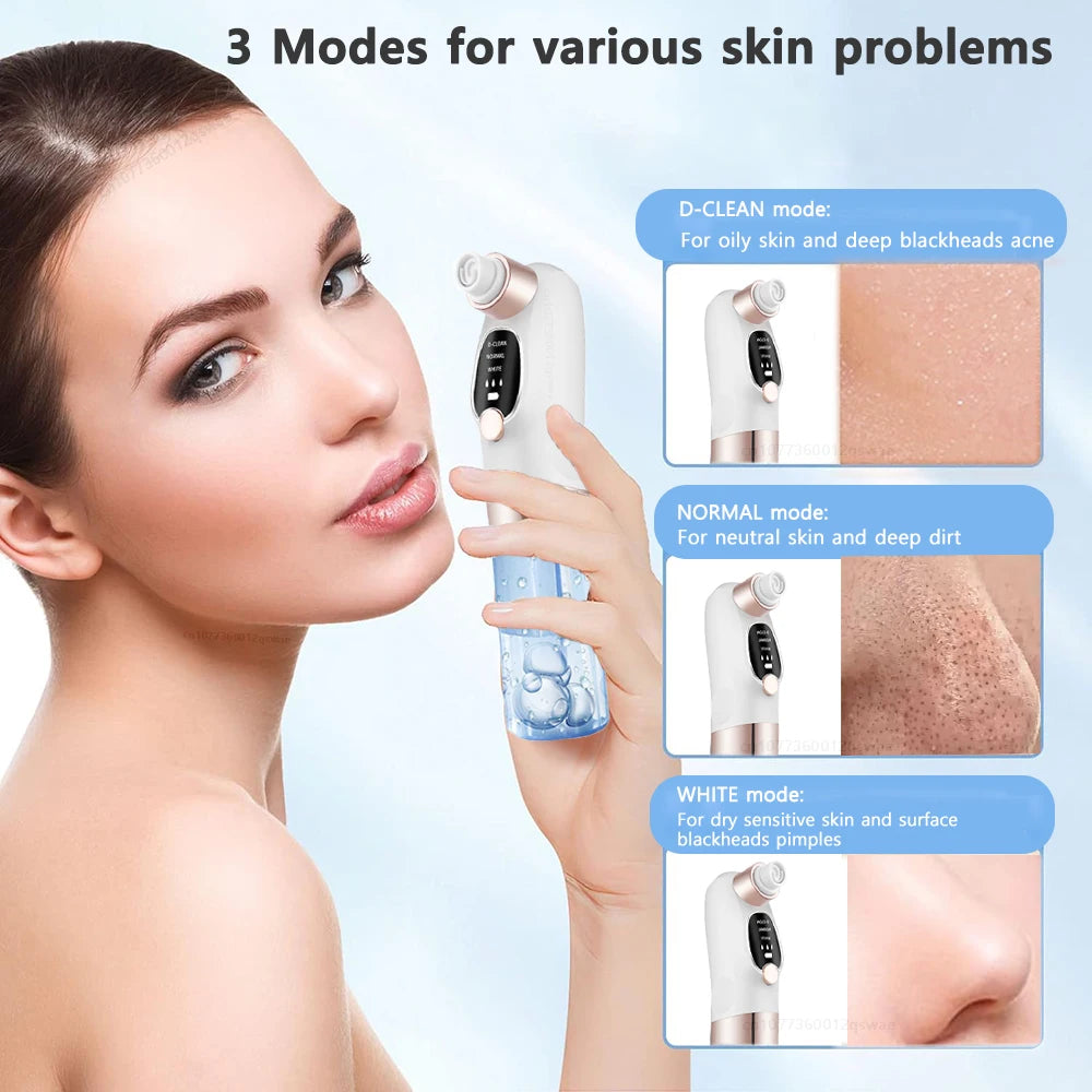 Blackhead Vacuum Deep Pore & Acne Cleaner