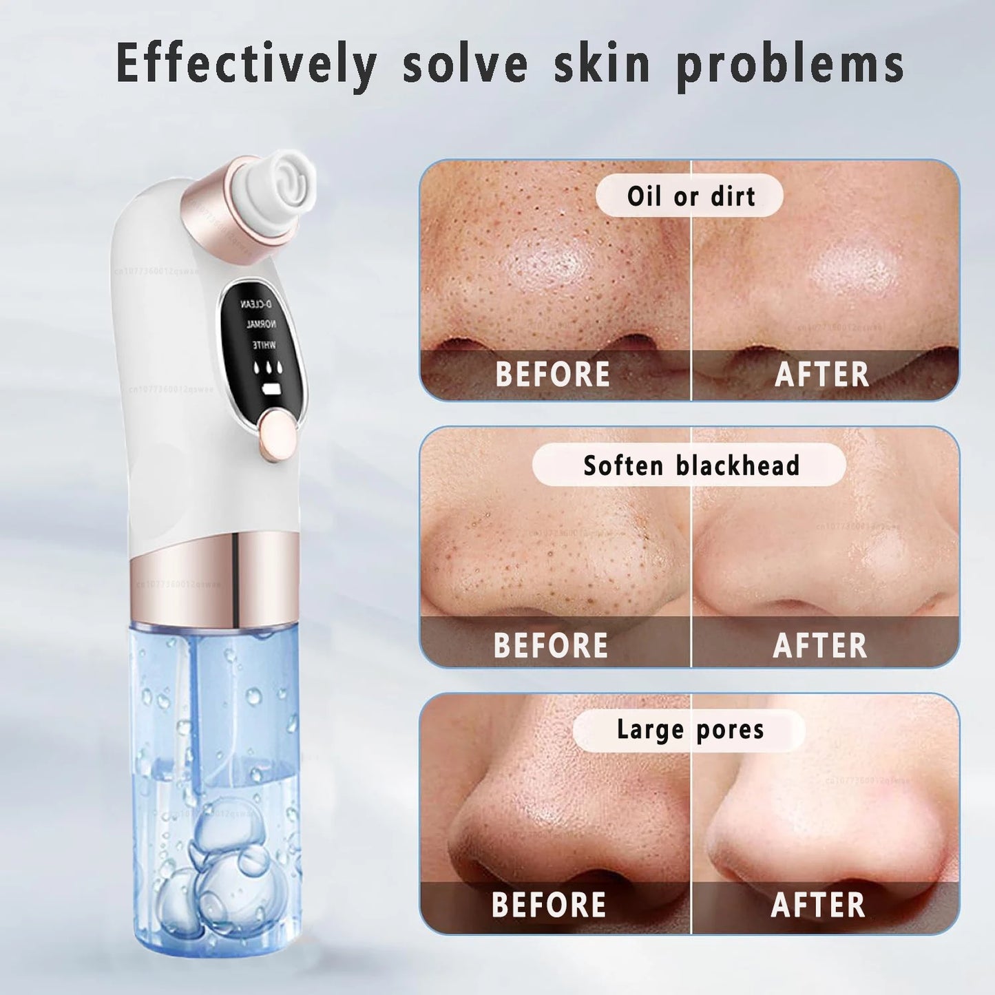 Blackhead Vacuum Deep Pore & Acne Cleaner
