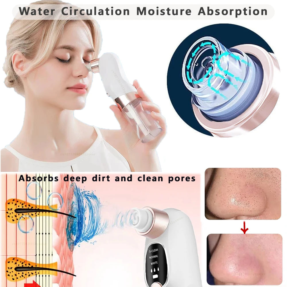 Blackhead Vacuum Deep Pore & Acne Cleaner